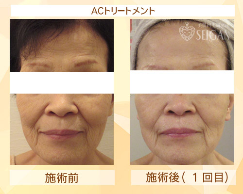 東京 からだのことなら|肌・頭皮(薄毛)の悩みの改善に「ヒト幹細胞と植物幹細胞による」メディカル系フェイシャルエステケア|FCR・リアボーテハーブ・ACトリートメント・クレアスキン基礎化粧品の正規取扱いサロンです。ニキビ・ニキビ跡(痕)・クレーター・色素沈着・シワ・シミ・たるみ・毛穴のお悩みに肌質改善を