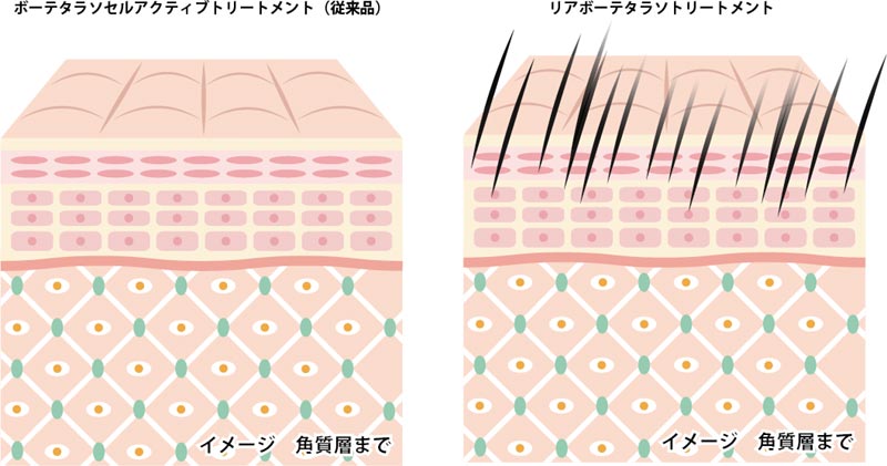 東京 からだのことなら｜肌・頭皮（薄毛）の悩みの改善に「ヒト幹細胞と植物幹細胞による」メディカル系フェイシャルエステケア｜FCR・リアボーテハーブ・ACトリートメント・クレアスキン基礎化粧品の正規取扱いサロンです。ニキビ・ニキビ跡（痕）・クレーター・色素沈着・シワ・シミ・たるみ・毛穴のお悩みに肌質改善を