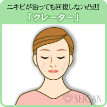 クレーターの悩み｜東京 からだのことなら｜肌・頭皮（薄毛）の悩みの改善に「ヒト幹細胞と植物幹細胞による」メディカル系フェイシャルエステケア【FCR・リアボーテハーブ・ACトリートメント・クレアスキン基礎化粧品の正規取扱いサロン】