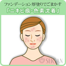 ニキビ跡（痕）・色素沈着の悩み｜東京 からだのことなら｜肌・頭皮（薄毛）の悩みの改善に「ヒト幹細胞と植物幹細胞による」メディカル系フェイシャルエステケア【FCR・リアボーテハーブ・ACトリートメント・クレアスキン基礎化粧品の正規取扱いサロン】