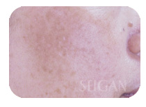 リアボーテお試し幹細胞トリートメント ｜【東京 港区 北青山】「からだのことなら」は、肌・髪・体・心の悩み改善に「丁寧に寄り添う」メディカル系ケア施術院です。肌質改善・加齢肌対策・薄毛・抜け毛をはじめ、体調不良・痛みなどでお悩みなら1度ご来院下さい。