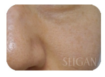 リアボーテお試し幹細胞トリートメント ｜【東京 港区 北青山】「からだのことなら」は、肌・髪・体・心の悩み改善に「丁寧に寄り添う」メディカル系ケア施術院です。肌質改善・加齢肌対策・薄毛・抜け毛をはじめ、体調不良・痛みなどでお悩みなら1度ご来院下さい。