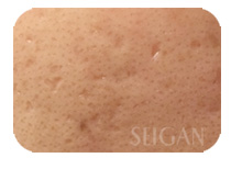 リアボーテお試し幹細胞トリートメント ｜【東京 港区 北青山】「からだのことなら」は、肌・髪・体・心の悩み改善に「丁寧に寄り添う」メディカル系ケア施術院です。肌質改善・加齢肌対策・薄毛・抜け毛をはじめ、体調不良・痛みなどでお悩みなら1度ご来院下さい。