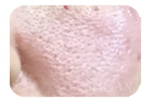 リアボーテお試し幹細胞トリートメント ｜【東京 港区 北青山】「からだのことなら」は、肌・髪・体・心の悩み改善に「丁寧に寄り添う」メディカル系ケア施術院です。肌質改善・加齢肌対策・薄毛・抜け毛をはじめ、体調不良・痛みなどでお悩みなら1度ご来院下さい。