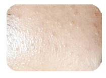 リアボーテお試し幹細胞トリートメント ｜【東京 港区 北青山】「からだのことなら」は、肌・髪・体・心の悩み改善に「丁寧に寄り添う」メディカル系ケア施術院です。肌質改善・加齢肌対策・薄毛・抜け毛をはじめ、体調不良・痛みなどでお悩みなら1度ご来院下さい。