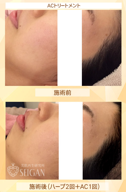 【東京 港区 北青山】「からだのことなら」は、肌・髪・体・心の悩み改善に「丁寧に寄り添う」メディカル系ケア施術院です。肌質改善・加齢肌対策・薄毛・抜け毛をはじめ、体調不良・痛みなどでお悩みなら1度ご来院下さい。