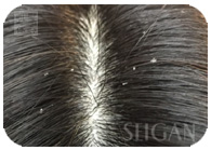 お試し幹細胞頭皮トリートメント｜【東京 港区 北青山】「からだのことなら」は、肌・髪・体・心の悩み改善に「丁寧に寄り添う」メディカル系ケア施術院です。薄毛・抜け毛・フケ・弱毛・頭皮のトラブル・白髪などでお悩みなら1度ご来院下さい。ACトリートメントとリアムール商品を使ったヘッドマッサージで頭皮ケアを行います。