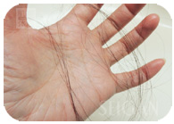 お試し幹細胞頭皮トリートメント｜【東京 港区 北青山】「からだのことなら」は、肌・髪・体・心の悩み改善に「丁寧に寄り添う」メディカル系ケア施術院です。薄毛・抜け毛・フケ・弱毛・頭皮のトラブル・白髪などでお悩みなら1度ご来院下さい。ACトリートメントとリアムール商品を使ったヘッドマッサージで頭皮ケアを行います。