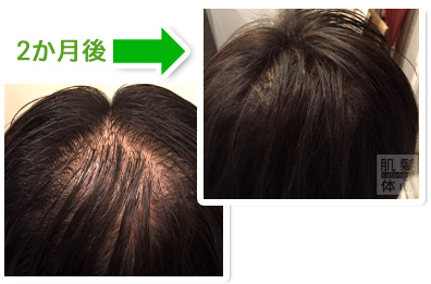 お試し幹細胞頭皮トリートメント｜【東京 港区 北青山】「からだのことなら」は、肌・髪・体・心の悩み改善に「丁寧に寄り添う」メディカル系ケア施術院です。薄毛・抜け毛・フケ・弱毛・頭皮のトラブル・白髪などでお悩みなら1度ご来院下さい。ACトリートメントとリアムール商品を使ったヘッドマッサージで頭皮ケアを行います。