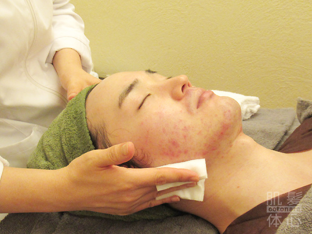 本気のメンズ美容フェイシャルサロンをお探しなら、東京 からだのことならへ｜男性の乾燥肌・ニキビ肌・カミソリ負け・テカリ肌・ザラザラ肌・薄毛の悩みの改善に「ヒト幹細胞と植物幹細胞による」メディカル系フェイシャルエステケア