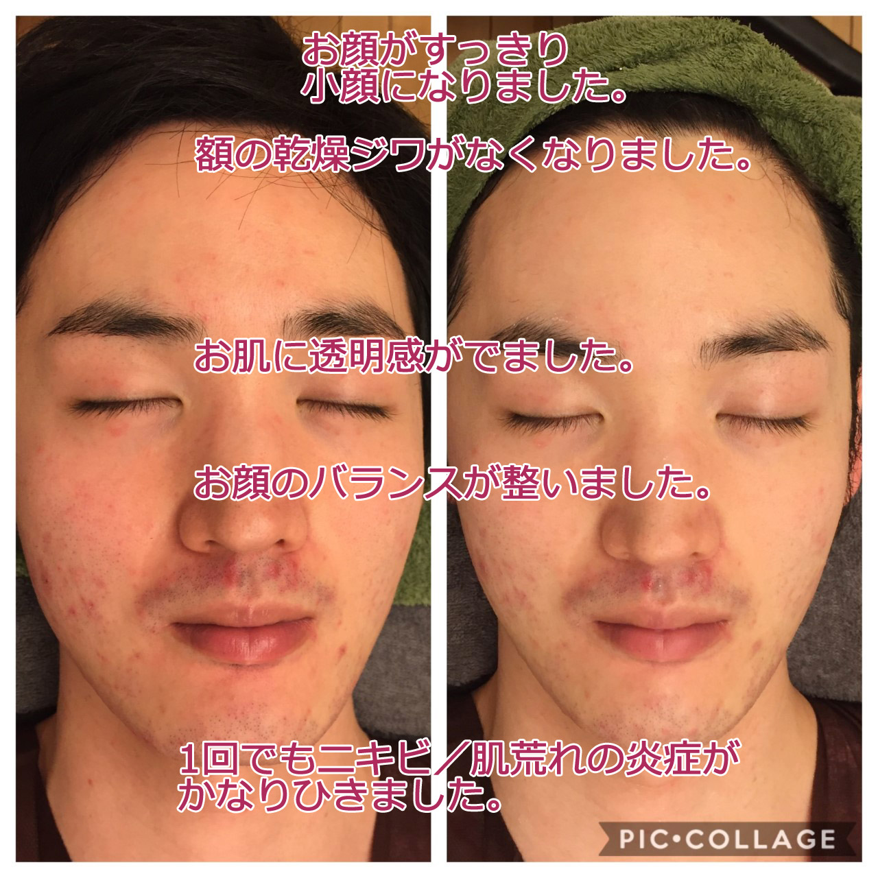 本気のメンズ美容フェイシャルサロンをお探しなら、東京 からだのことならへ｜男性の乾燥肌・ニキビ肌・カミソリ負け・テカリ肌・ザラザラ肌・薄毛の悩みの改善に「ヒト幹細胞と植物幹細胞による」メディカル系フェイシャルエステケア