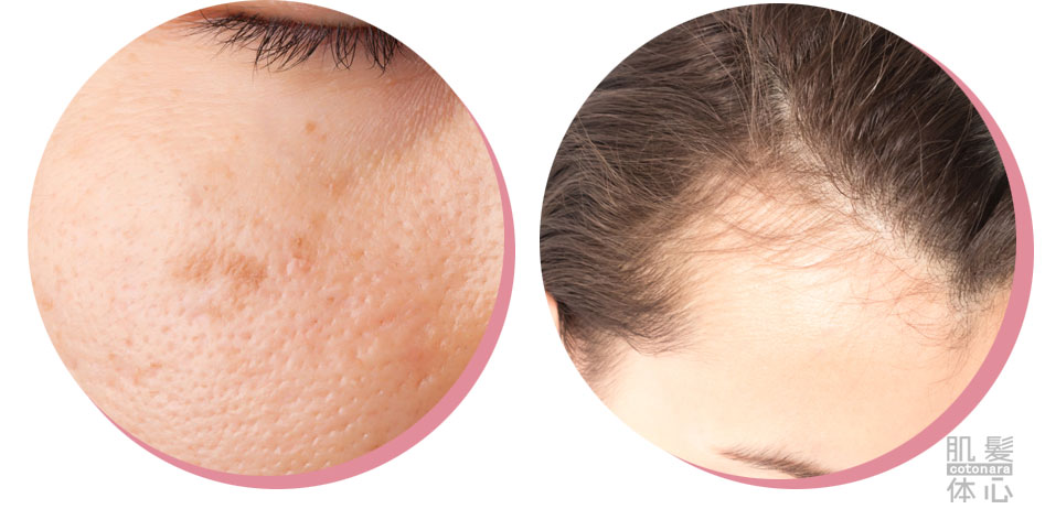 リアムールエキスパートローションのご購入はこちらから｜東京・世田谷区 正規取扱い販売店 からだのことなら｜直営通販ネットショップ運営