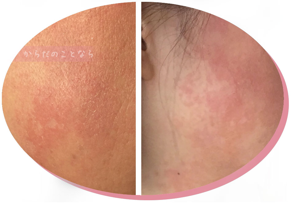 リアムールエキスパートローションのご購入はこちらから｜東京・世田谷区 正規取扱い販売店 からだのことなら｜直営通販ネットショップ運営