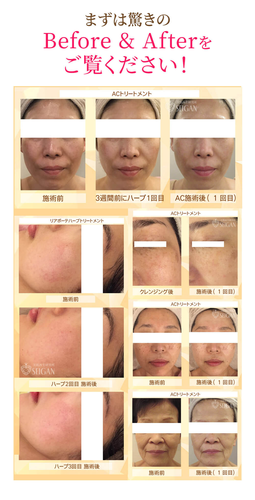 リアボーテ クレアスキン化粧品◆グランスキン化粧品のご購入はこちらから｜東京・世田谷区 正規取扱い販売店 からだのことなら【ビューティースキンラボ AnnaCarna】｜通販ネットショップ運営｜口コミ・効果・公式の使い方など