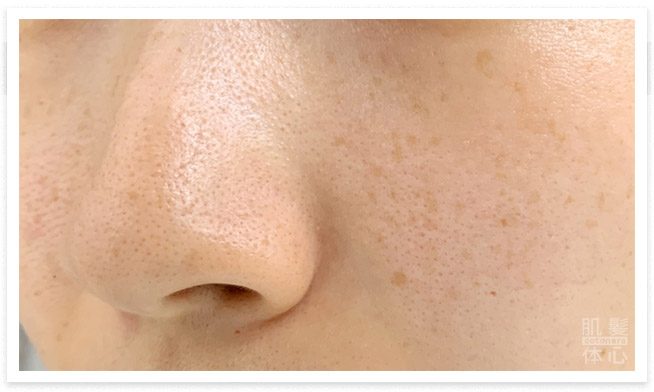 肌質改善｜からだのことなら【リアボーテ正規取扱販売店 ビューティースキンラボ AnnaCarna】｜クレアスキン化粧品・グランスキン化粧品・シェリースキン・エキスパートローション・アコライム・リアムールのご購入はこちらから｜口コミ・効果・使い方・通販ネットショップ