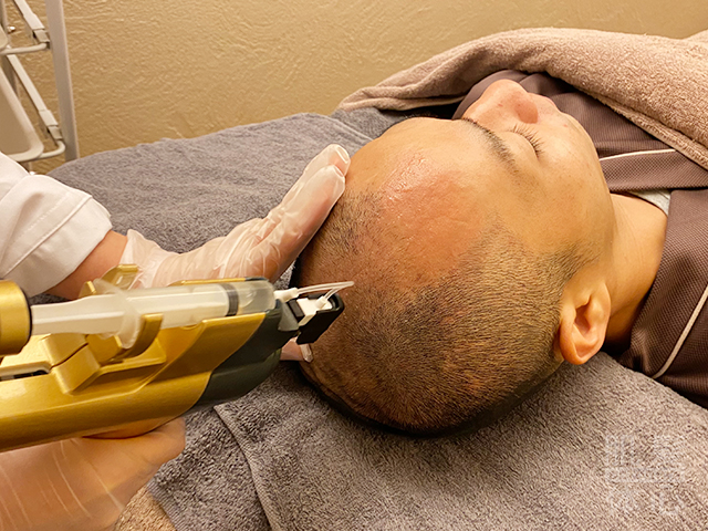 AC頭皮トリートメント|からだのことなら【リアボーテ正規取扱販売店 ビューティースキンラボ AnnaCarna】|クレアスキン化粧品・グランスキン化粧品・シェリースキン・エキスパートローション・アコライム・リアムールのご購入はこちらから|口コミ・効果・使い方・通販ネットショップ