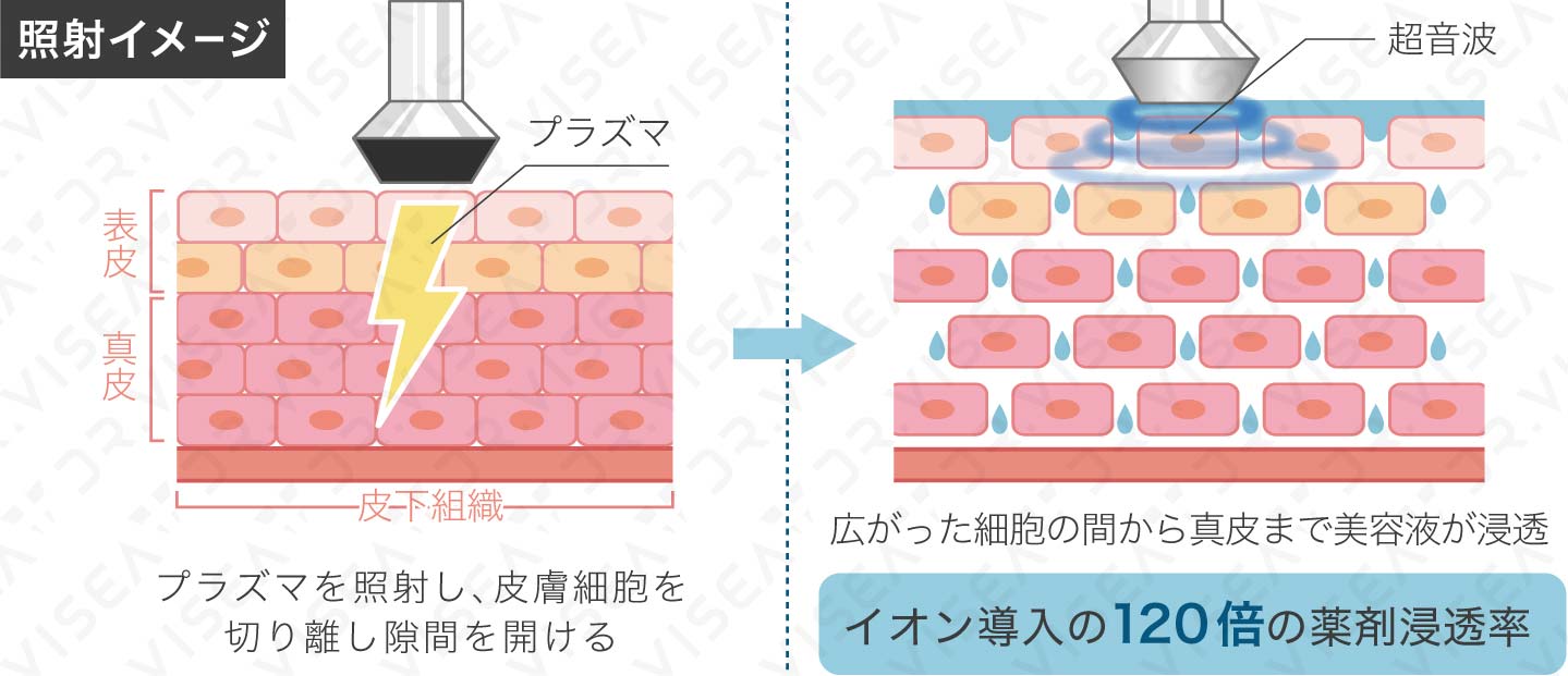 iPS BioCellCare AnnaCarna アンナカルナ【シミケア専科 プラズマ O:Celloオセロ 併設】 ≪高濃度ヒト幹細胞培養液/iPSフェイシャルエステサロン≫ 肌質改善☆年齢肌☆小顔矯正☆シミ取り専門◆シミ取り放題×プラズマミストシャワーコースが人気◆芸能人ご用達コスメ「リアボーテ」正規取扱店◆リアボーテクレアスキン化粧品・リアボーテグランスキン化粧品・リアボーテシェリースキン化粧品・エキスパートローション・リアムール・健美草｜口コミ・効果・使い方・ビフォーアフター・動画・写真・方法・通販・ネット販売・対象外商品★港区 南青山 銀座線 外苑前駅★青山一丁目駅★個室完備